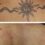 clinica barcelona borrar tatuaje laser antes y despues