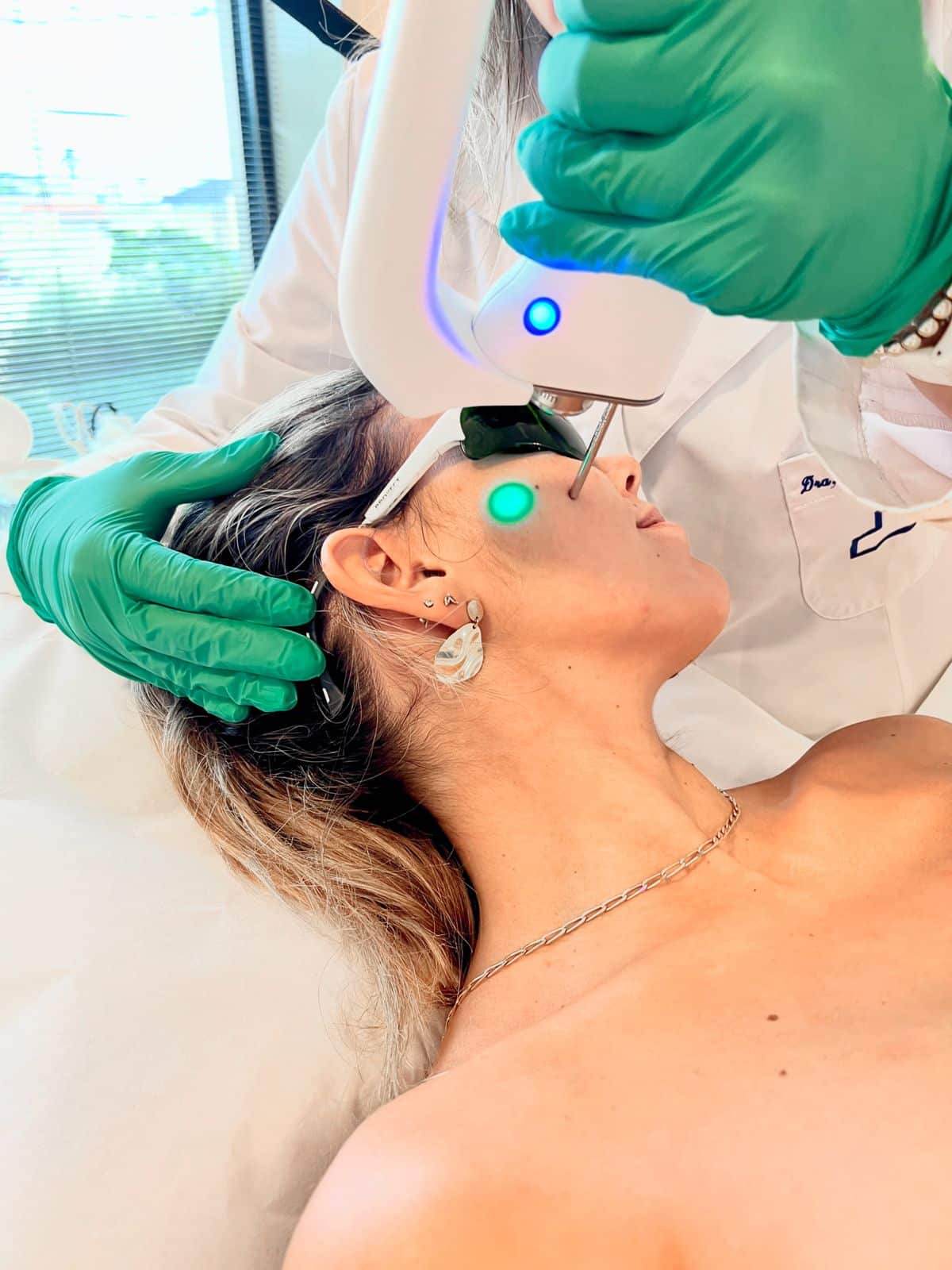 depilacion laser facial